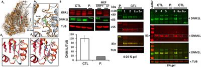 Case report: Thirty-year progression of an EMPF1 encephalopathy due to defective mitochondrial and peroxisomal fission caused by a novel de novo heterozygous DNM1L variant